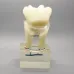 6:1 Orthodontic Teeth Model with Clear Base - Anatomical Molar Dissection for Dentist & Endodontics Teaching [Dental Education, Molar Anatomy]