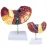 1:1 Pathological Liver Anatomical Model - Human Liver Anatomy Display for Medical Study & Research [Liver Model, Anatomy Display]