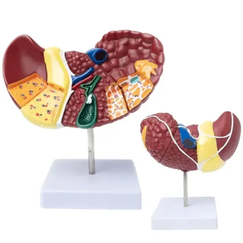 1:1 Pathological Liver Anatomical Model - Human Liver Anatomy Display for Medical Study & Research [Liver Model, Anatomy Display]