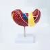 1:1 Pathological Liver Anatomical Model - Human Liver Anatomy Display for Medical Study & Research [Liver Model, Anatomy Display]