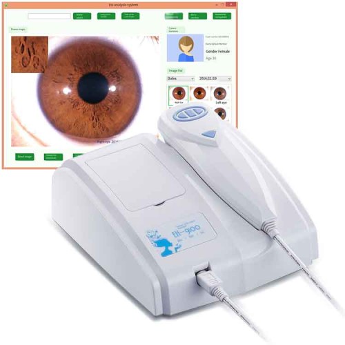 Digital Iridology Camera with Iris Analysis & Health Reports | 8MP HD Sensor | Customer Management System