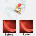 Prostate Massage Treatment Device with Infrared Heat Therapy for Physiotherapy & Prostate Calcification Relief