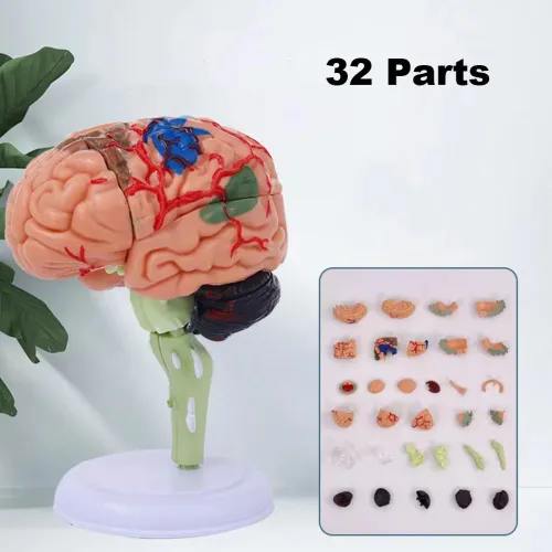 4D Disassembled Anatomical Human Brain Model - Medical Teaching Tool for Anatomy Study, PVC Material, Highly Detailed & Colorful