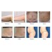 VelaShape Machine - Advanced Non-Invasive Body Contouring & Fat Reduction Device [Infrared, RF, Vacuum, Laser]
