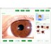 Digitale Iridologie Camera - 8MP Iris Analyzer met Auto Iris Analyse Software, Gezondheidstoestand Checker [Iridologie, Iris Analyzer]