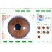 Digitale Iridologie Camera - 8MP Iris Analyzer met Auto Iris Analyse Software, Gezondheidstoestand Checker [Iridologie, Iris Analyzer]