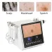Hydro Dermabrasion Machine with High-Pixel Skin Detection for Home Use, Scalp & Pores Care, Beauty Skin Microdermabrasion Device