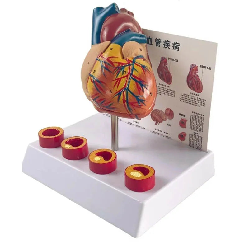 Life Size Removable Anatomical Human Heart Model - Cardiovascular Anatomy Medical Teaching Tool [Heart Model, Medical Anatomy]