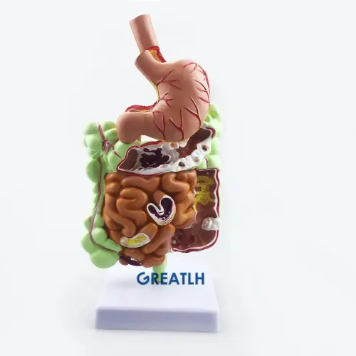 1/2 Life-Size Stomach Large Intestine Cecum Rectal Anatomy Model - Human Digestive System Teaching Tool [Anatomy Model, Digestive System]