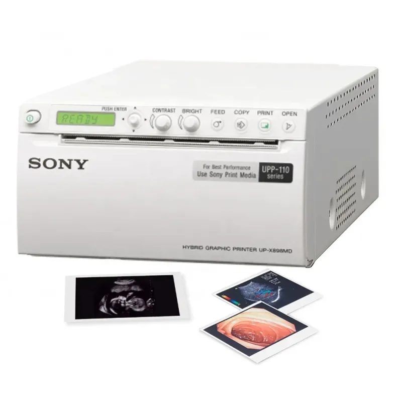 UP-X898MD Medical 3D 4D Doppler ultrahangos videonyomtató – Hordozható hőnyomtató állatorvosi és orvosi képalkotáshoz [nagy sebességű, kompakt, USB-tároló]