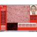 HD 5MP Facial Skin Analyzer - Comprehensive Skin Analysis for Acne, Oily, Moisture & More | Beauty Spa Skin Scope