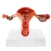 1:1 Lifesize Female Uterus Ovary Pathology Model - Anatomical Teaching Aid for Medical Study [Uterus Model, Pathology Display, Medical Anatomy]