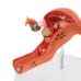 1:1 Lifesize Female Uterus Ovary Pathology Model - Anatomical Teaching Aid for Medical Study [Uterus Model, Pathology Display, Medical Anatomy]