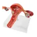 1:1 Lifesize Female Uterus Ovary Pathology Model - Anatomical Teaching Aid for Medical Study [Uterus Model, Pathology Display, Medical Anatomy]