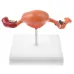 1:1 Lifesize Female Uterus Ovary Pathology Model - Anatomical Teaching Aid for Medical Study [Uterus Model, Pathology Display, Medical Anatomy]