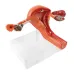 1:1 Lifesize Female Uterus Ovary Pathology Model - Anatomical Teaching Aid for Medical Study [Uterus Model, Pathology Display, Medical Anatomy]